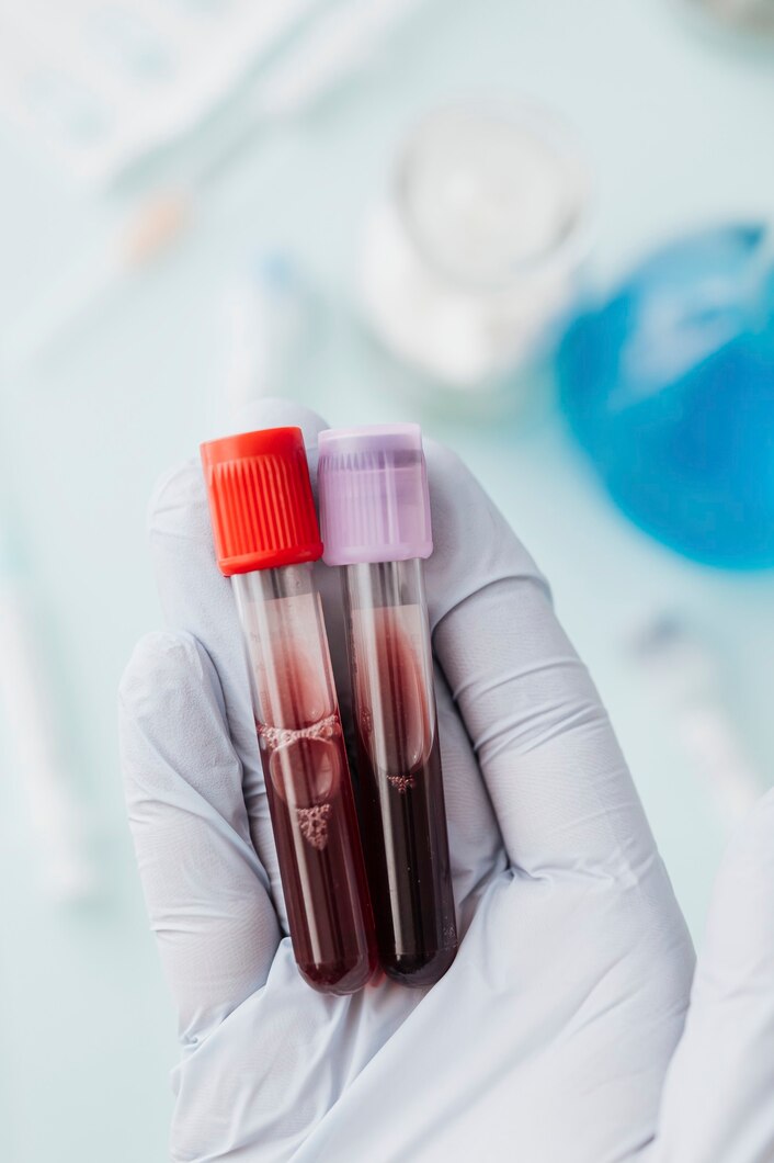 Blood Test